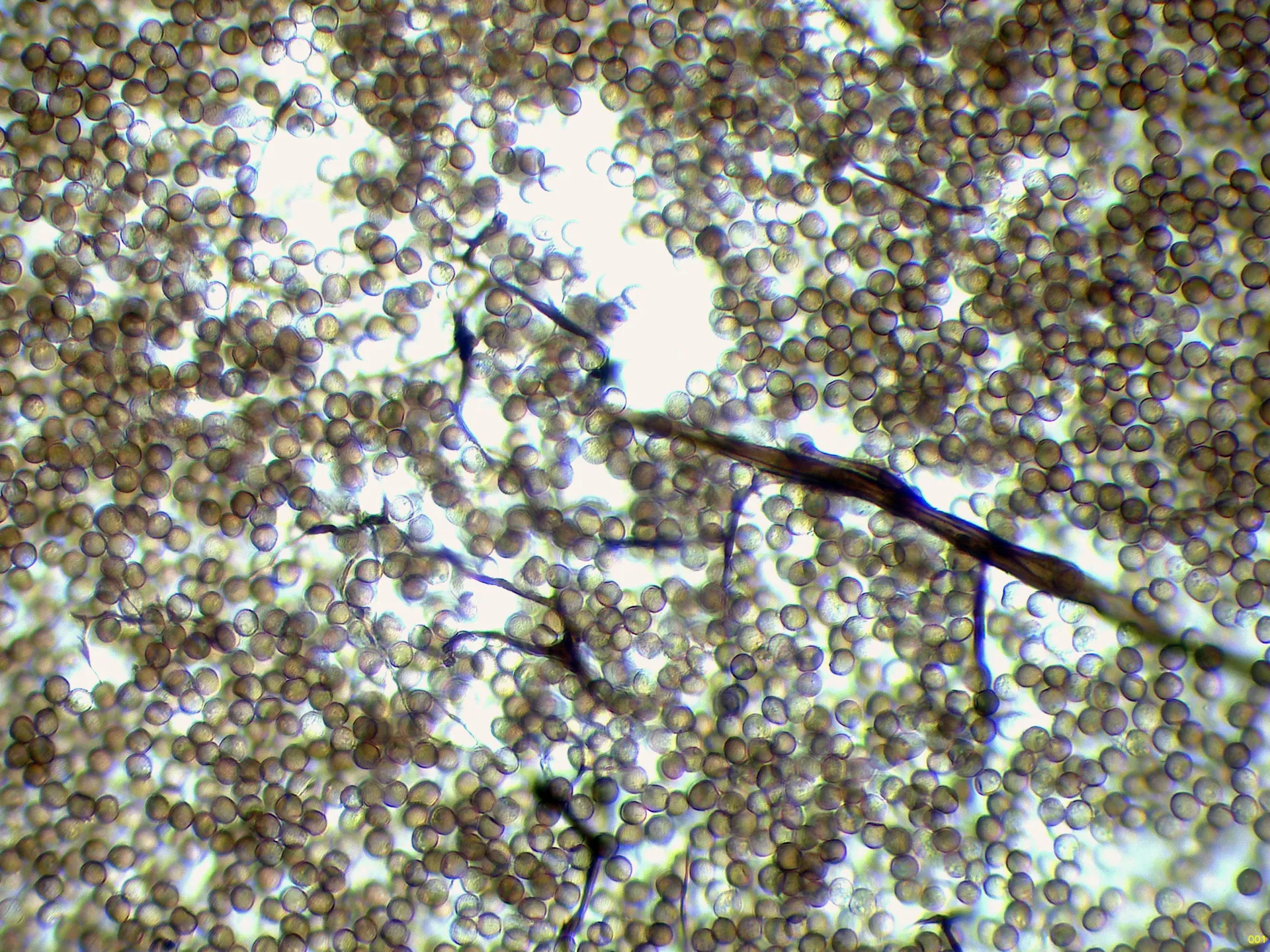 Microscopía de Stemonitis pallida - 12 - Ápice columela agua x 400-001